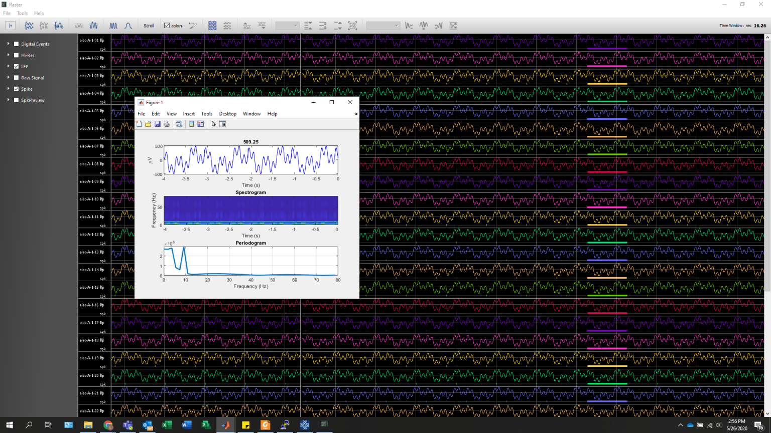 Trellis EEG & ERP Acquisition Software Ripple Neuro